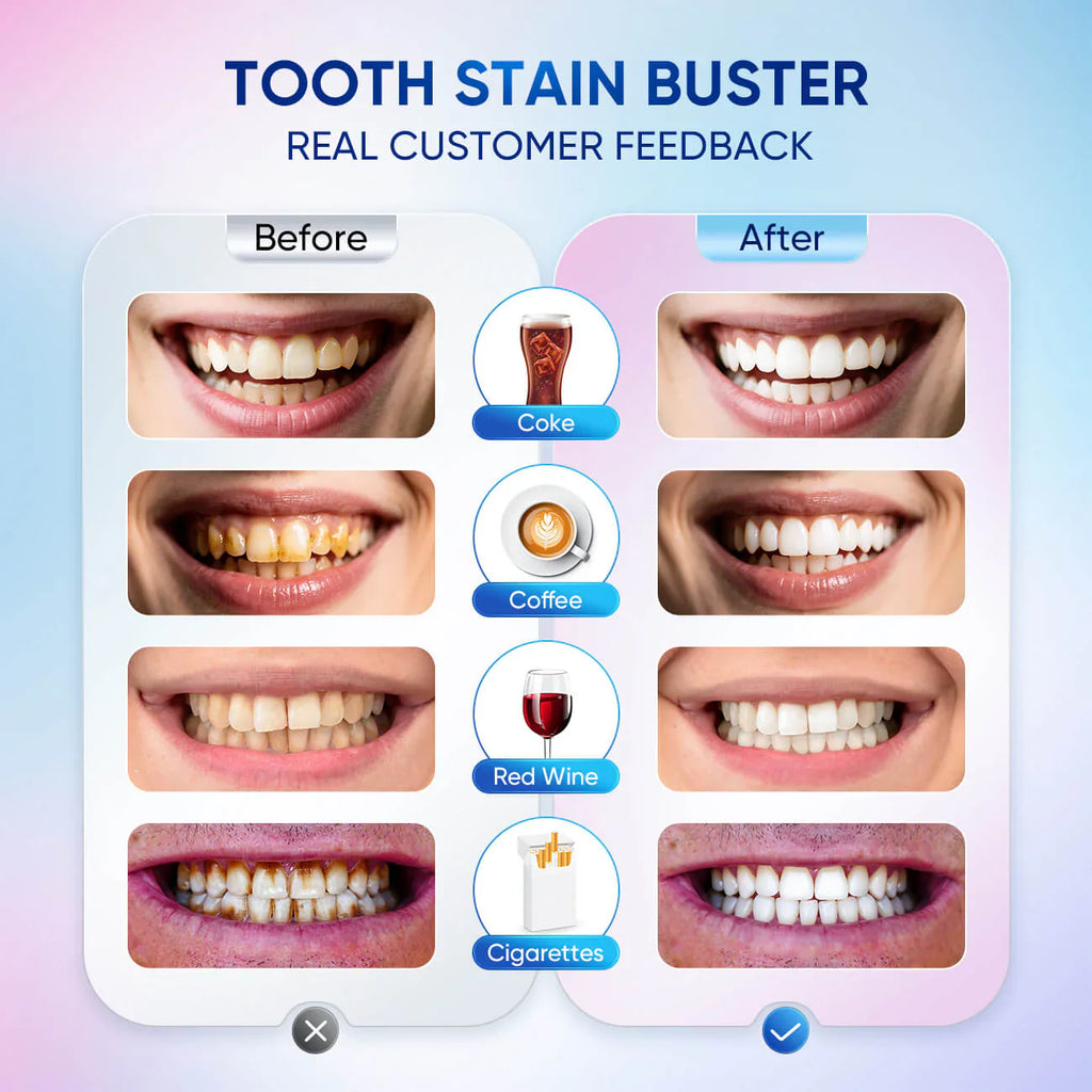 Body Accel  toothpaste Rs (1080)