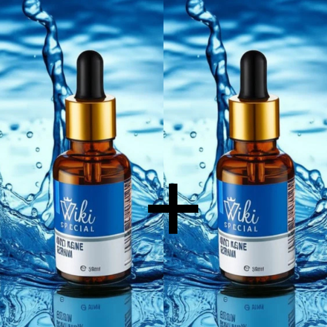 Viki Special Anti Acne Serum – 30ml | Deep Pore Cleansing & Blemish Control Formula For Clearer Skin